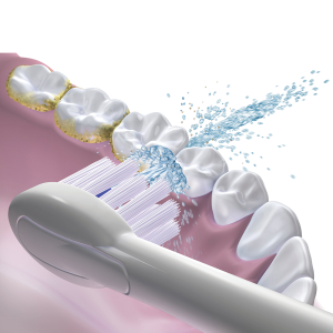 Waterpik Sonic Fusion Professional SF-02 White, sonická kefka s ústným irigátorom