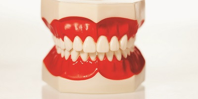Parodontitída - riziko pre zuby a ďasná aj celkové zdravie