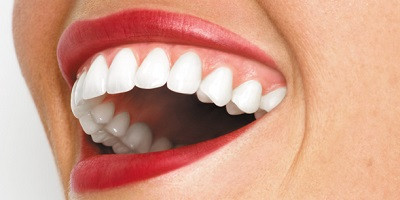 Biele zuby z pohľadu odborníka
