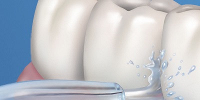 Efektívne čistenie zubov pulzujúcim prúdom vody
