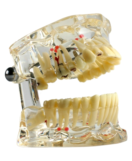 Miradent Fantom DE LUXE, transparentný